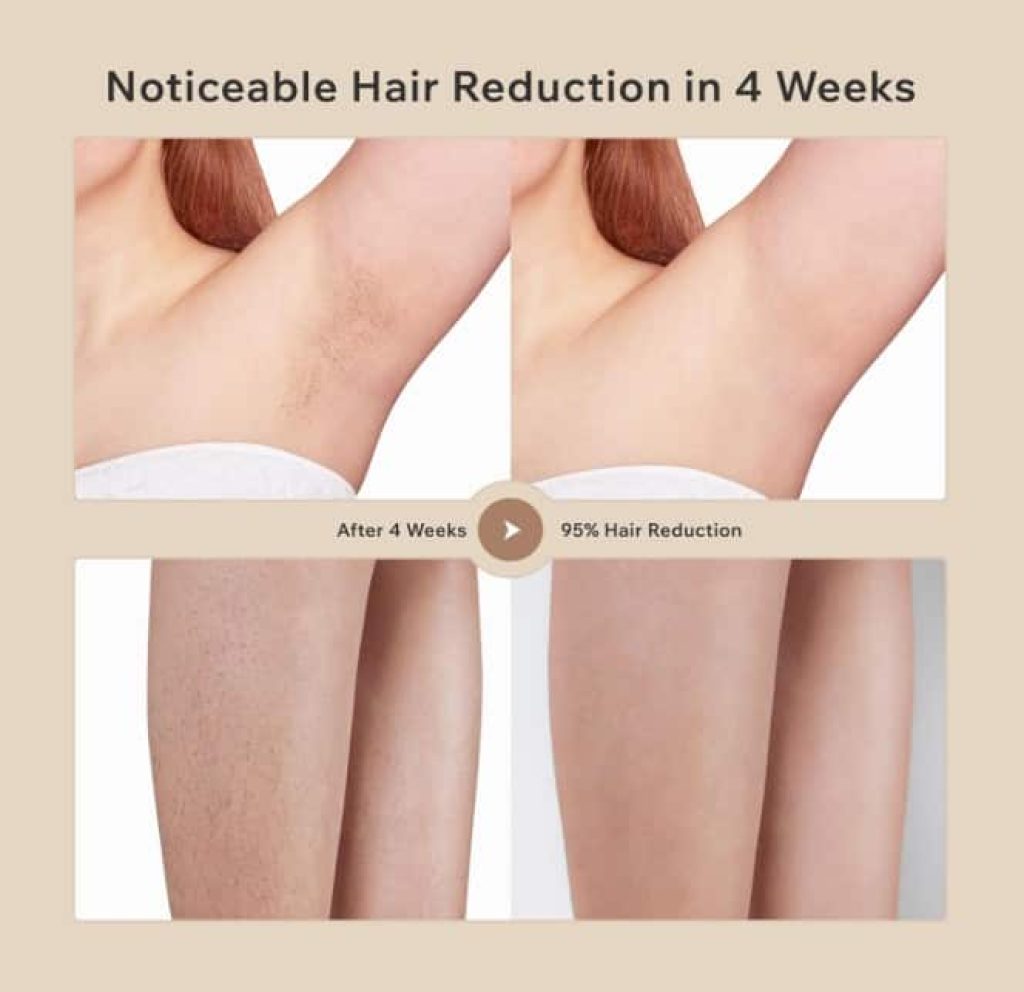 3 en 1 Depiladora Laser IPL con Mode RH/AR/SC, Pantalla Táctil LCD, 9 Nivel de Energía, 999.900 Flashes, Max 19.35 J, Depiladora Luz Pulsada para Piernas, Bikini, Axilas, Cara, Cuerpo